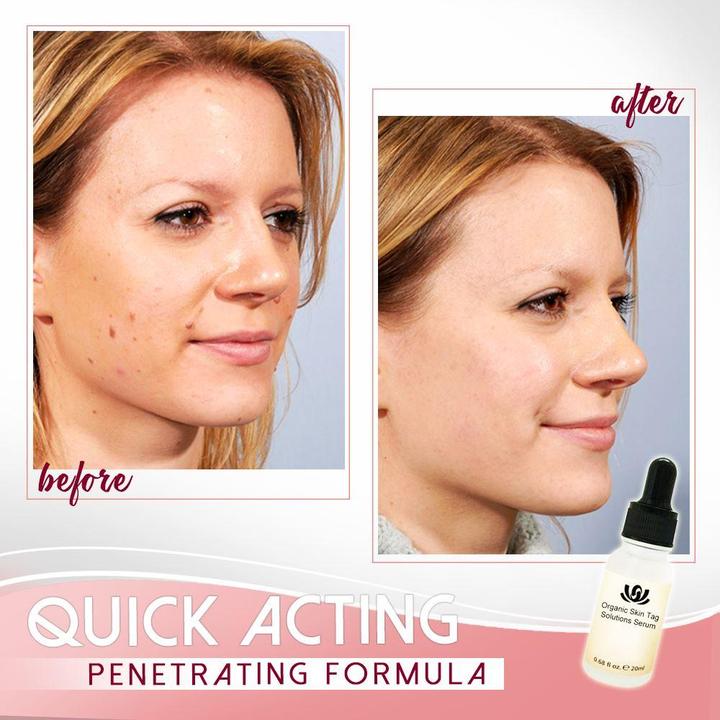 Organic Skin Spot Solution Serum